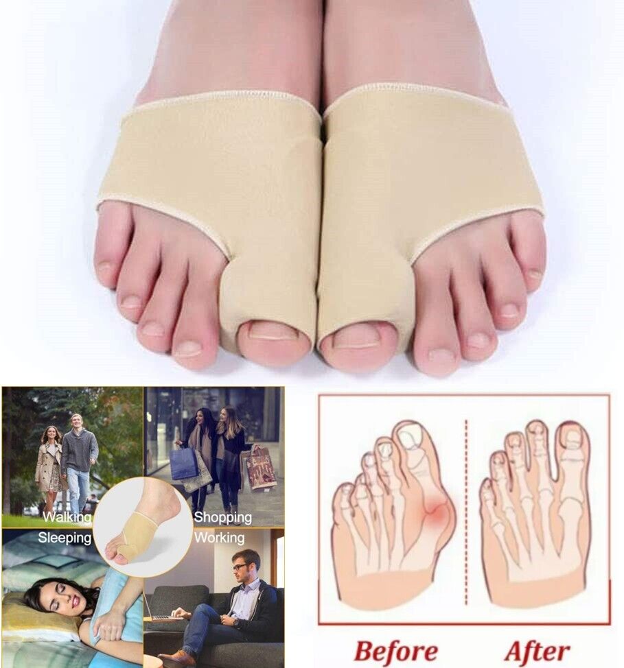 Big Toe Bunion Corrector